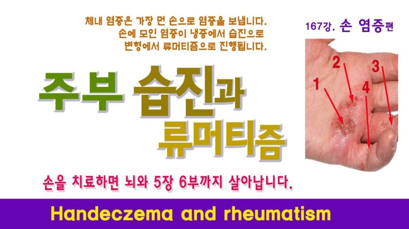 1769168744 maxresdefault