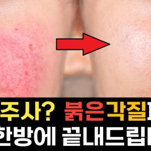 1769170185 maxresdefault