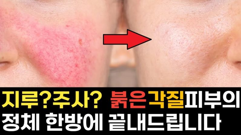 1769170185 maxresdefault