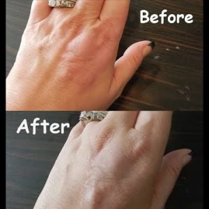 1769176851 hqdefault