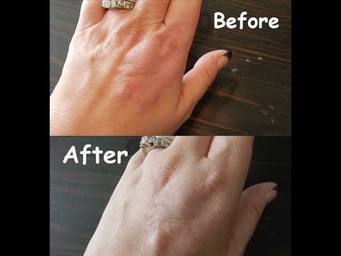 1769176851 hqdefault