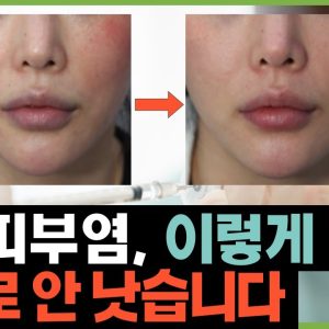 1769176922 maxresdefault