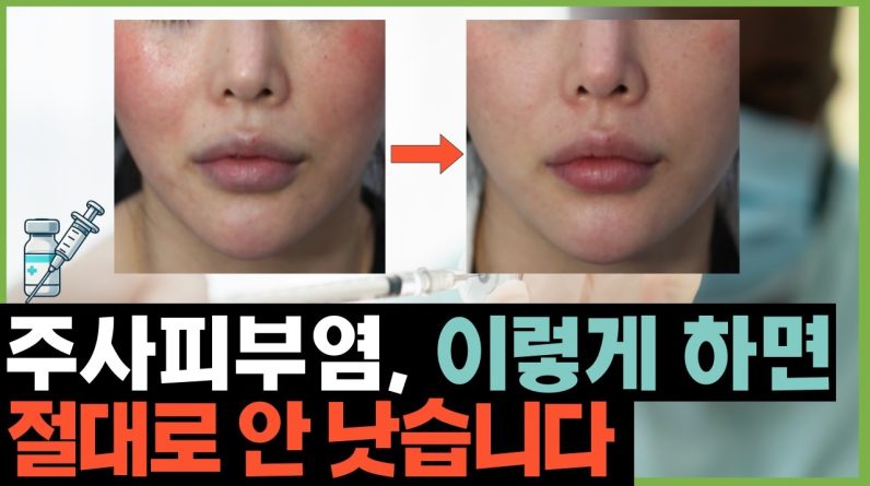 1769176922 maxresdefault