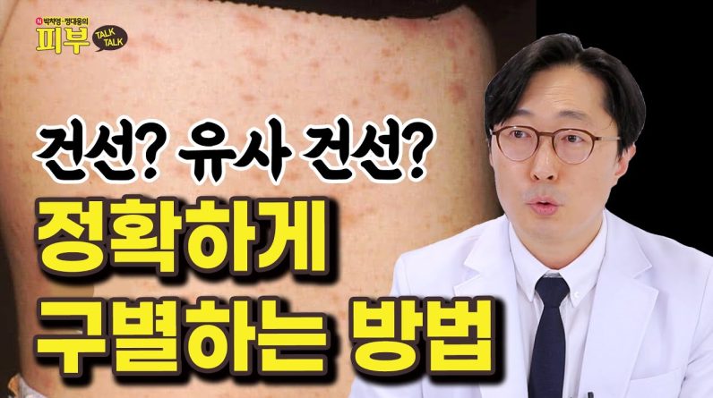 1769187108 maxresdefault