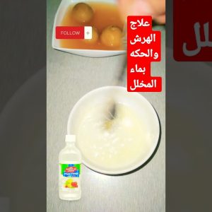 1769187647 maxresdefault