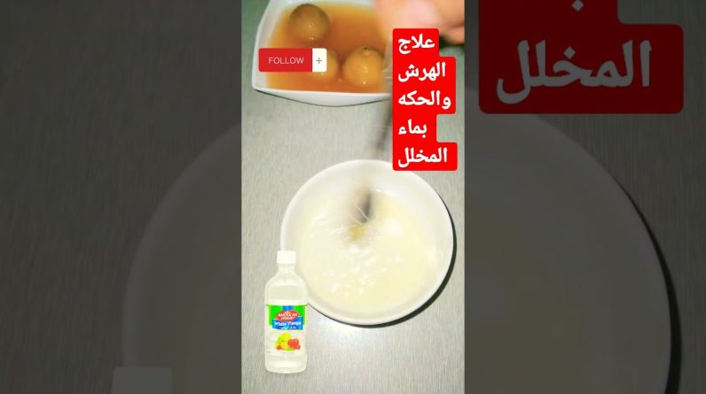 1769187647 maxresdefault