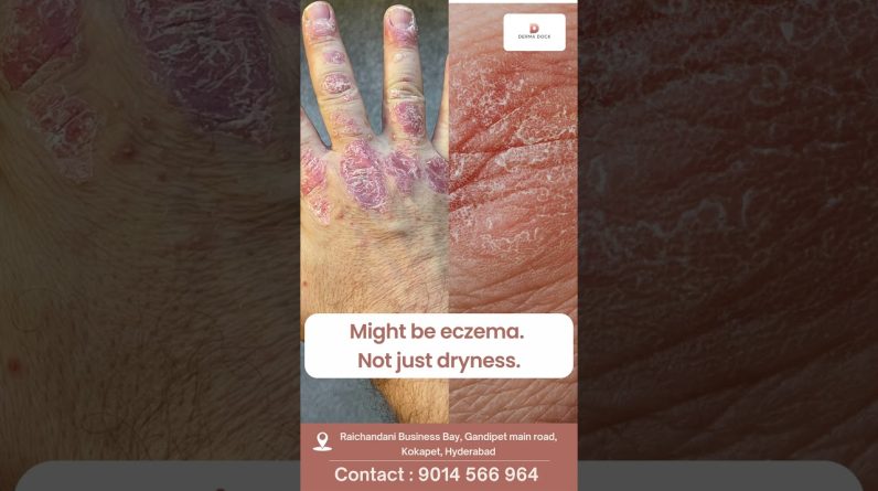 1769203186 maxresdefault