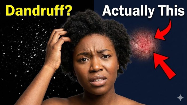 1769212729 maxresdefault