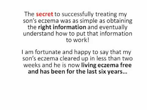 1769250056 hqdefault