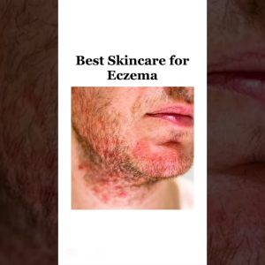 1769272101 maxresdefault