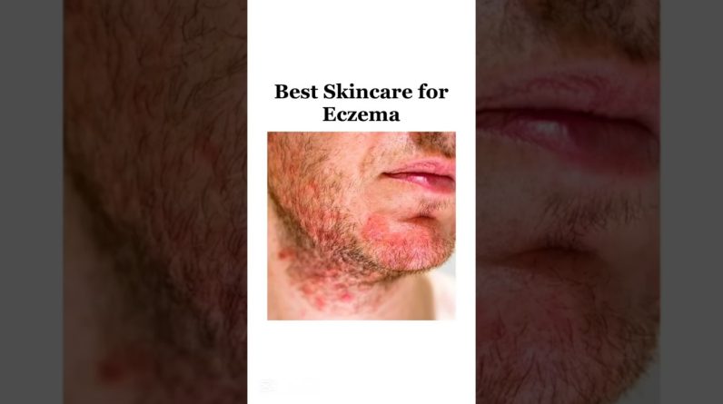 1769272101 maxresdefault