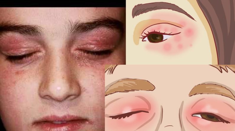 1769334226 maxresdefault