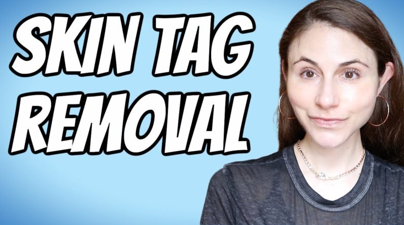 1769355704 maxresdefault