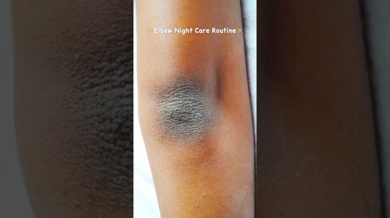 1769363028 maxresdefault