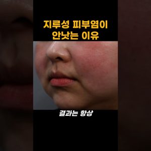 1769422866 maxresdefault