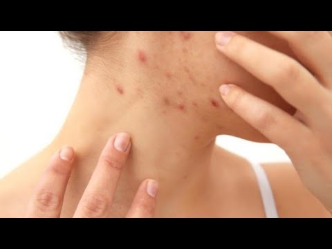 1769437049 hqdefault