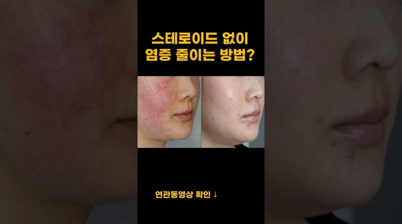 1769440003 maxresdefault