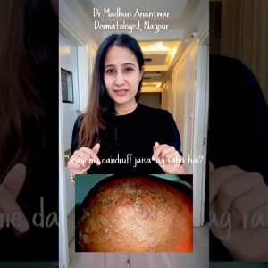 1769440720 maxresdefault