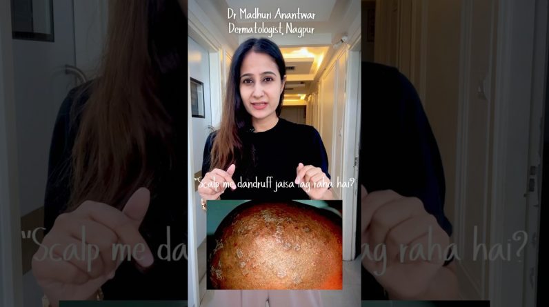 1769440720 maxresdefault