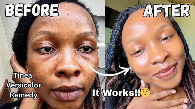 1769597290 maxresdefault