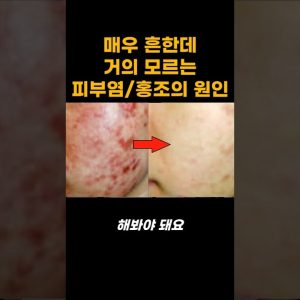 1769711332 maxresdefault