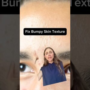 1769781283 maxresdefault