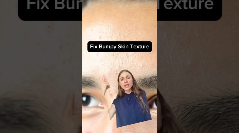 1769781283 maxresdefault