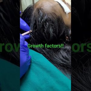 1769828739 maxresdefault