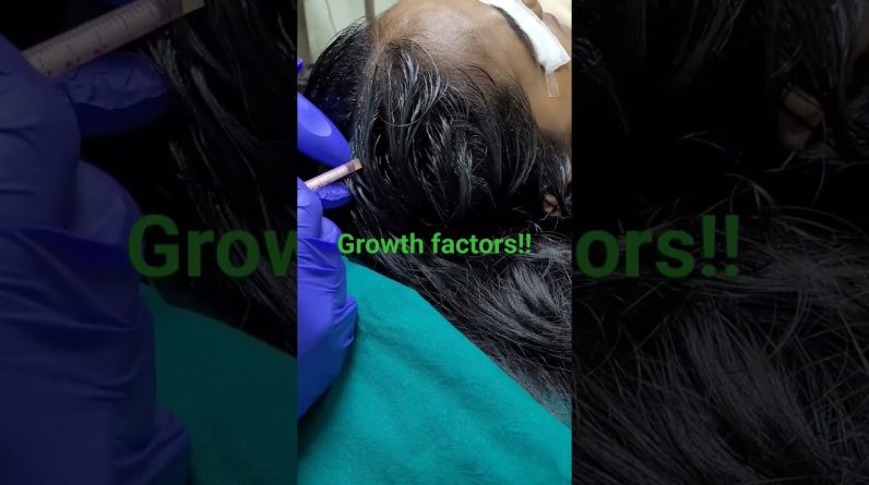 1769828739 maxresdefault