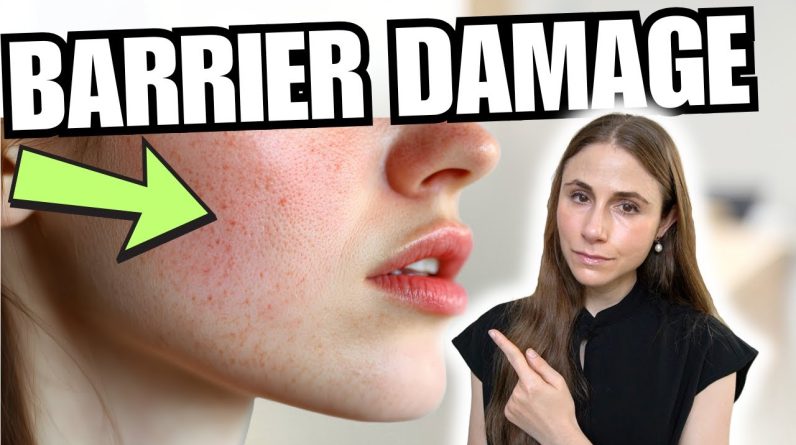 1769858387 maxresdefault