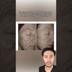 1769865555 maxresdefault