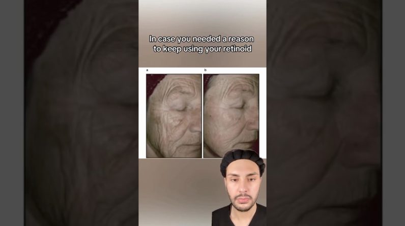 1769865555 maxresdefault