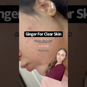 1769873144 maxresdefault