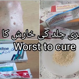 1769884153 maxresdefault