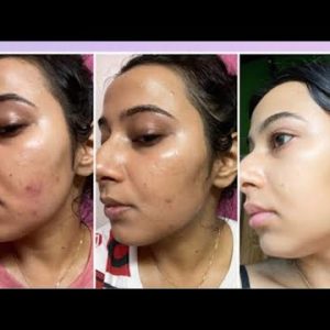 1769902132 hqdefault