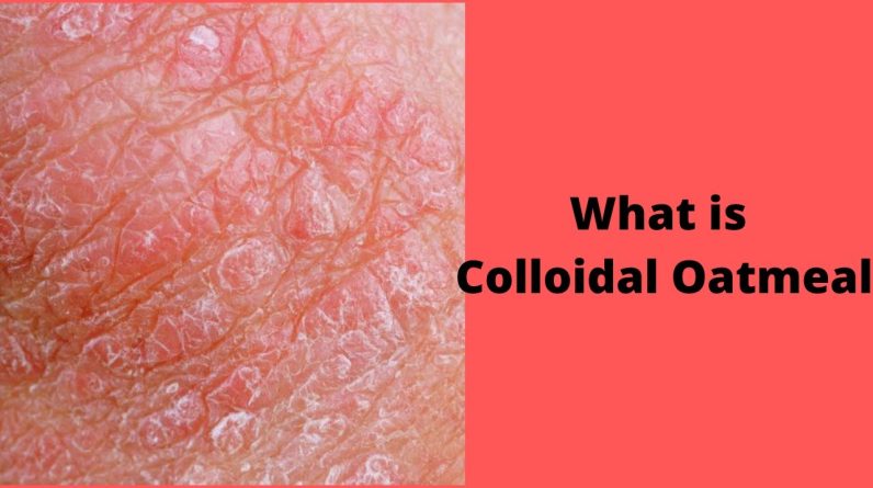 1769906078 maxresdefault