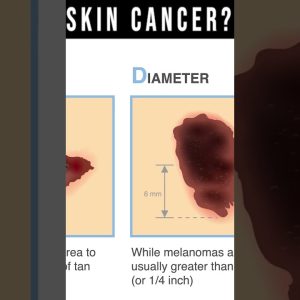 1769949720 maxresdefault