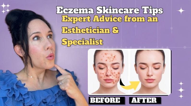 1770045105 maxresdefault