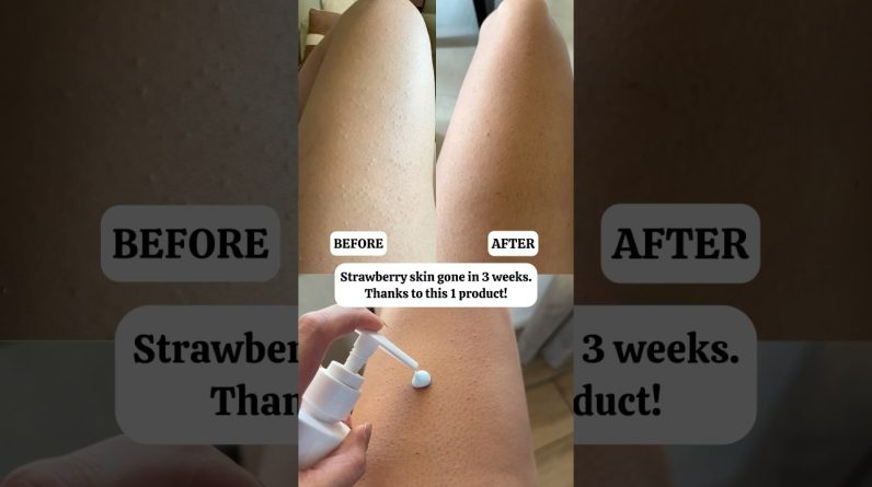 1770058848 maxresdefault