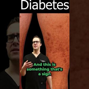 1770106497 maxresdefault