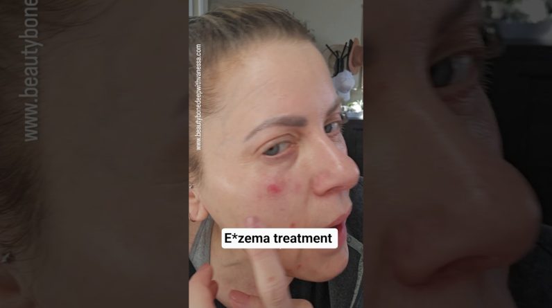 1770136244 maxresdefault