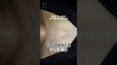 1770194801 maxresdefault