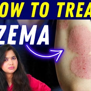 1770377870 maxresdefault