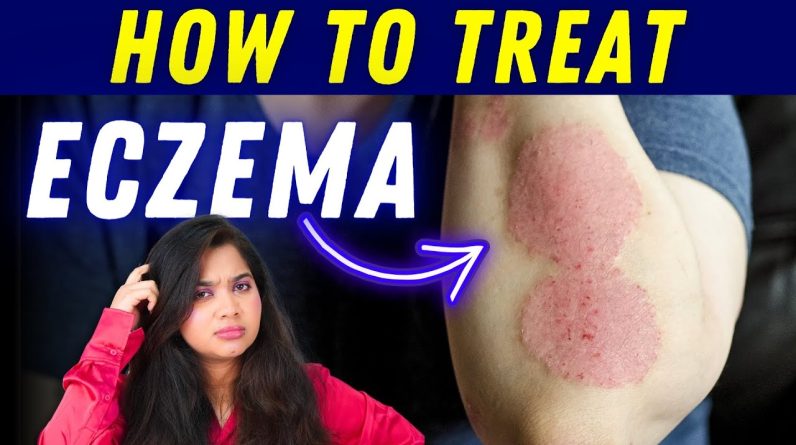 1770377870 maxresdefault