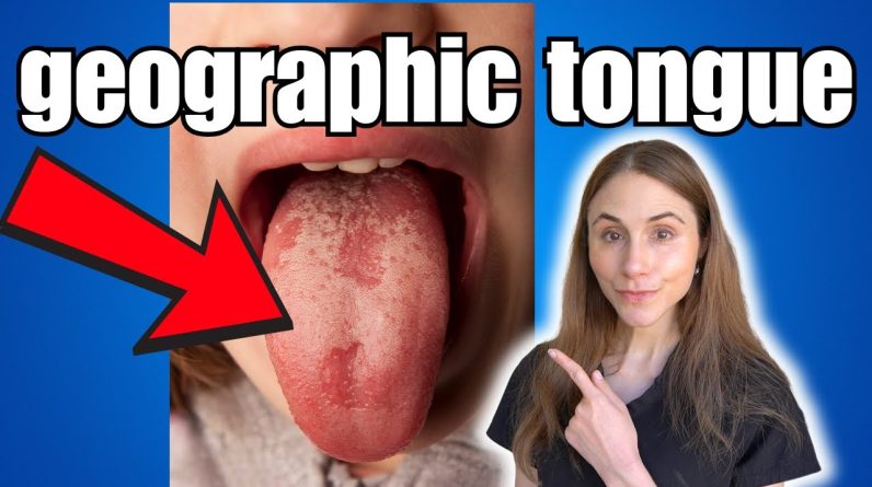 1770385929 maxresdefault