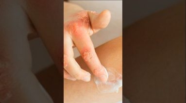 1770392706 maxresdefault