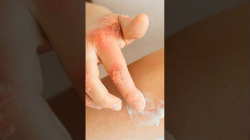 1770392706 maxresdefault