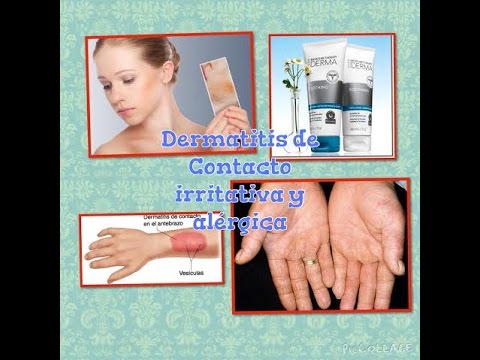 1770400260 hqdefault