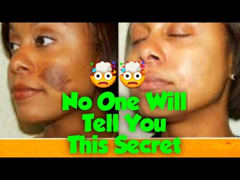 1770411603 hqdefault