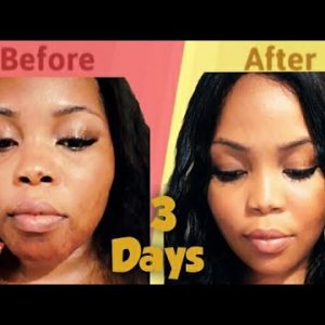 1770433608 hqdefault